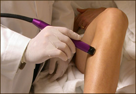 Post image for Laser Hair Removal: Thinning Out the Hair